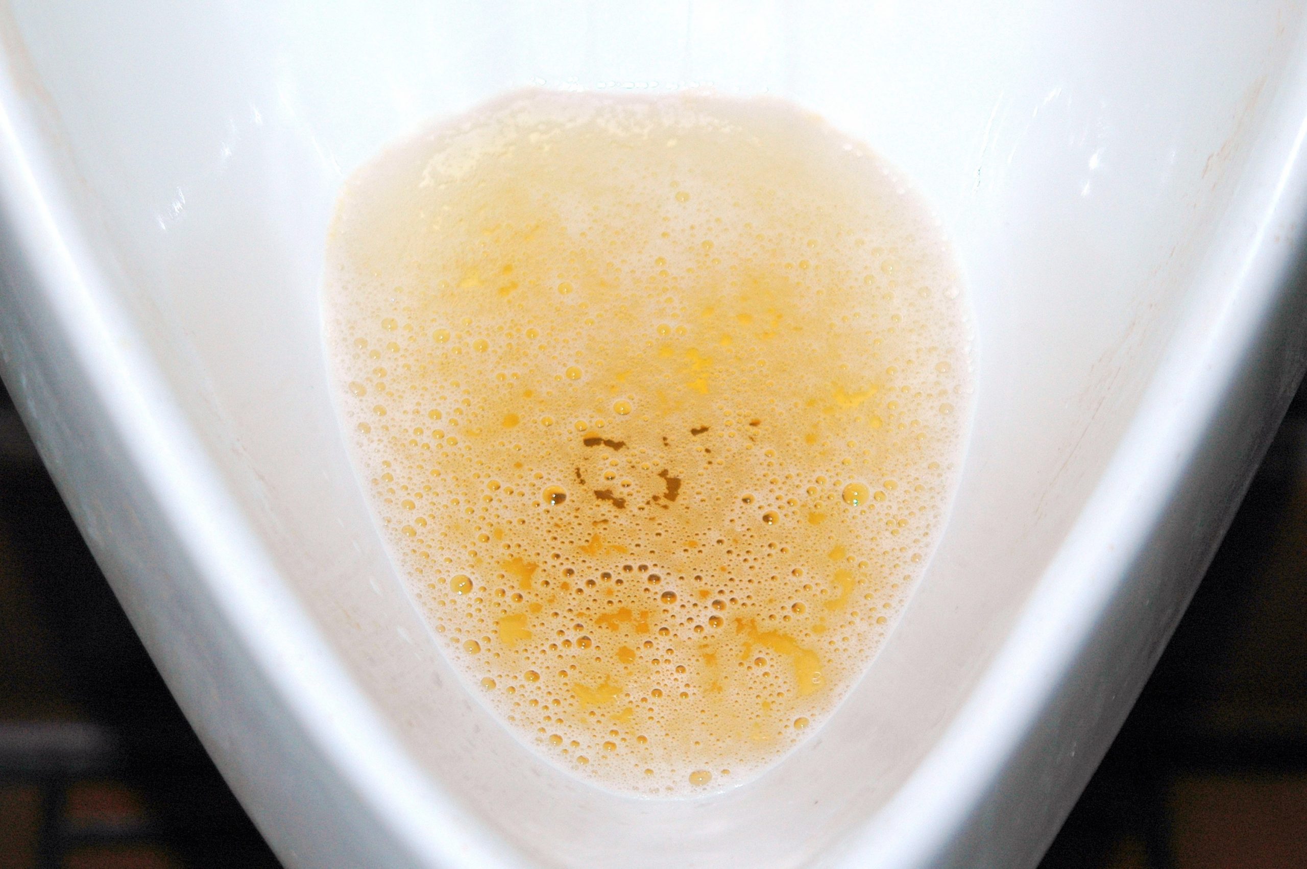 yellow urine in toilet bowl
