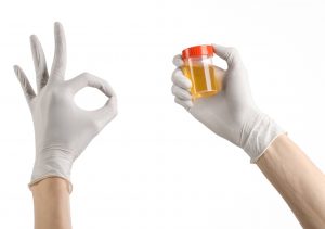 gloved hand hold urine sample signing okay