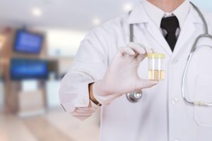 doctor's hand holding a bottle of urine sample in hospital