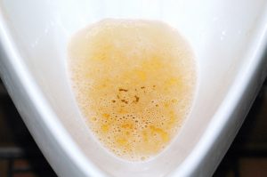 foaming urine inside urinal