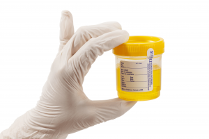 Can labs dectect synthetic urine