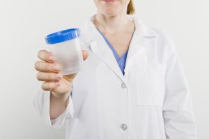 female nurse holding empty urine specimen cup