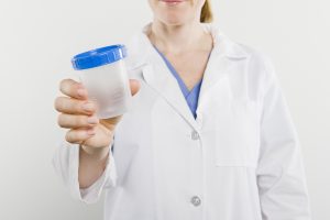 female nurse holding empty urine specimen cup