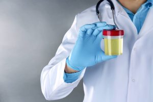 doctor holding plastic jar with urine
