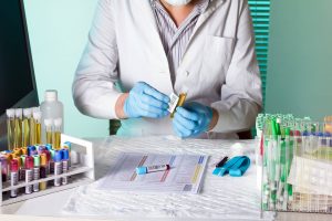 laboratory technician holding and labeling sample tubes of urine