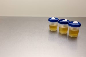 urine samples