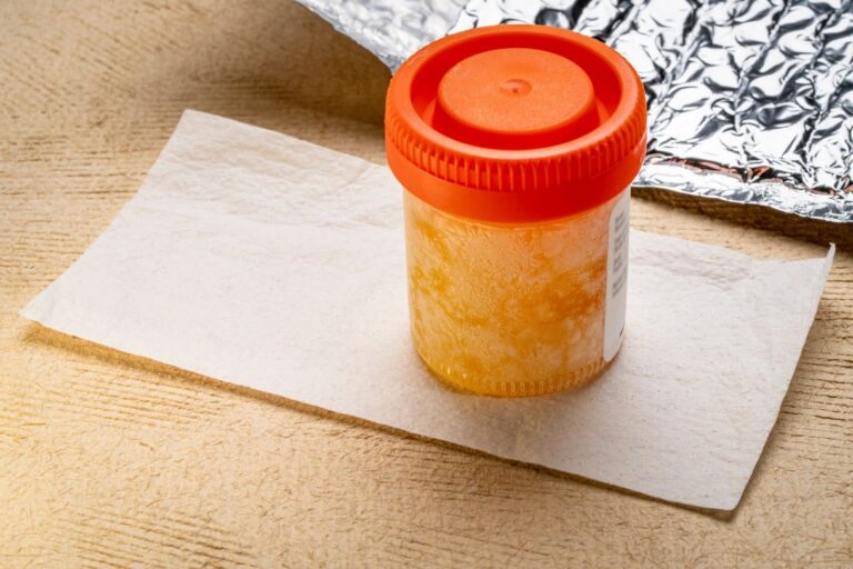 Can You Freeze Urine for a Drug Test?