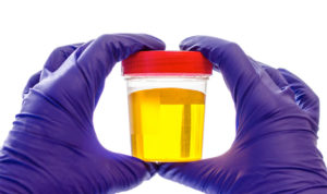 synthetic urine in a cup