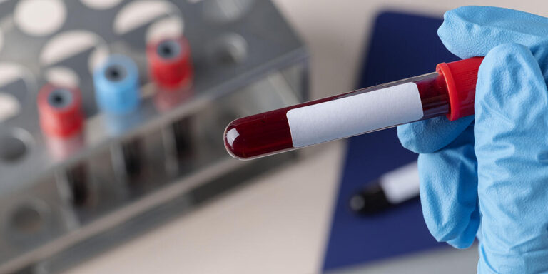 Blood Test vs. Urine Test – What’s the Difference?
