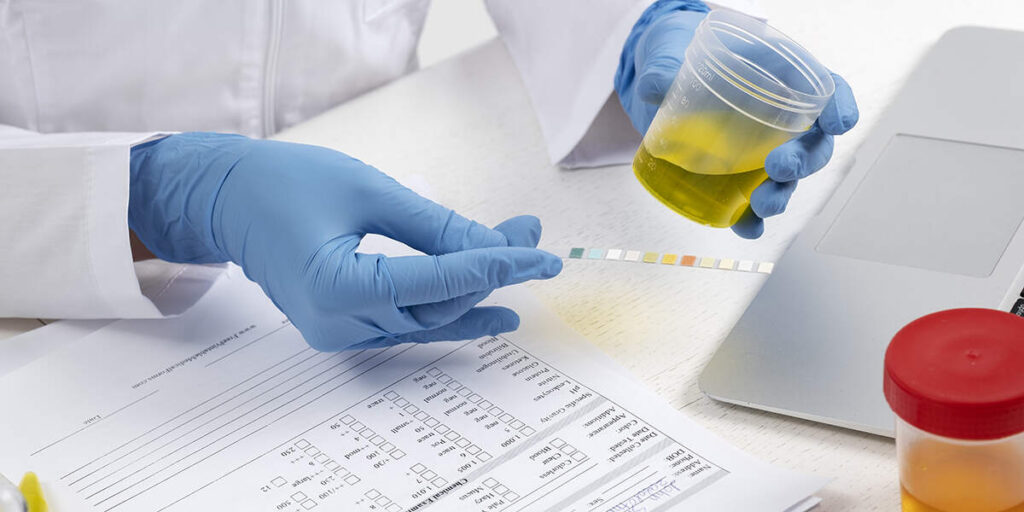 how far does urine test go back​