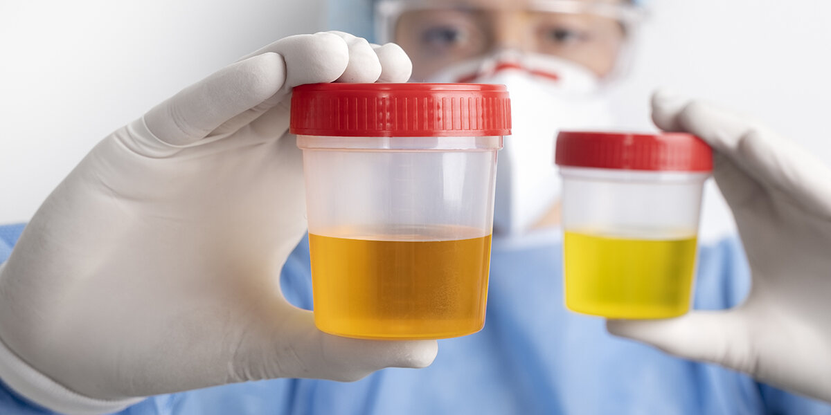 urine test