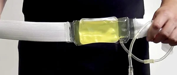 Empty Urine Belt Kit- Refillable - Image 2