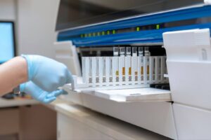 A scientist in a laboratory places test tubes with urine in the container of a thermal analyzer