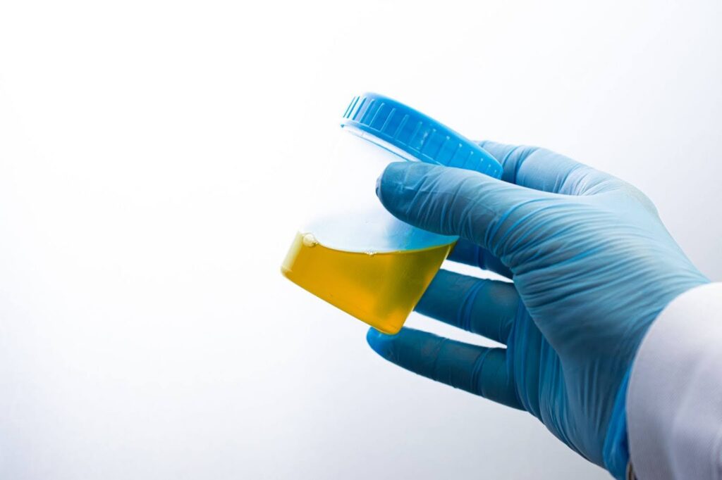 Gloved hand holding a urine sample cup for a drug test temperature check at a collection site