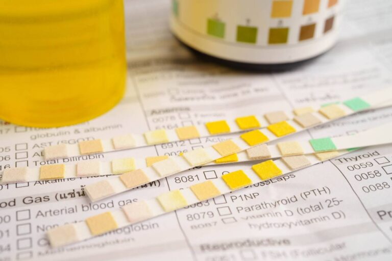 Failed Drug Tests and Urine Temperature: Temp Rules & Why You May Fail