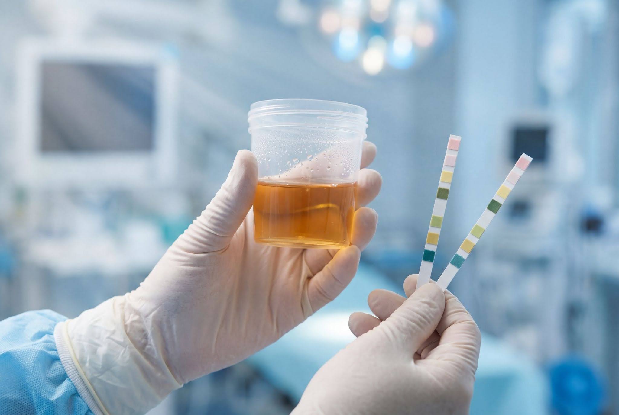 Does LabCorp Test for Synthetic Urine?