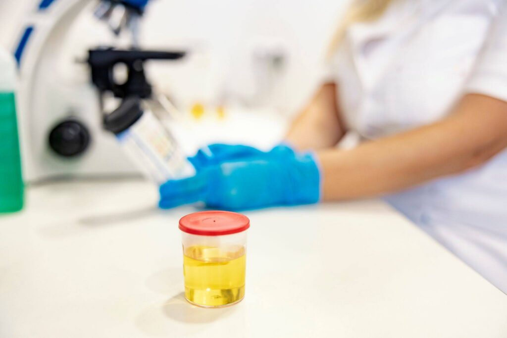 A lab technician analyzes urine samples with a microscope
