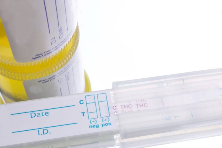 Urine Temperature for Drug Test: Ideal Range, Why It Matters & How It’s Checked