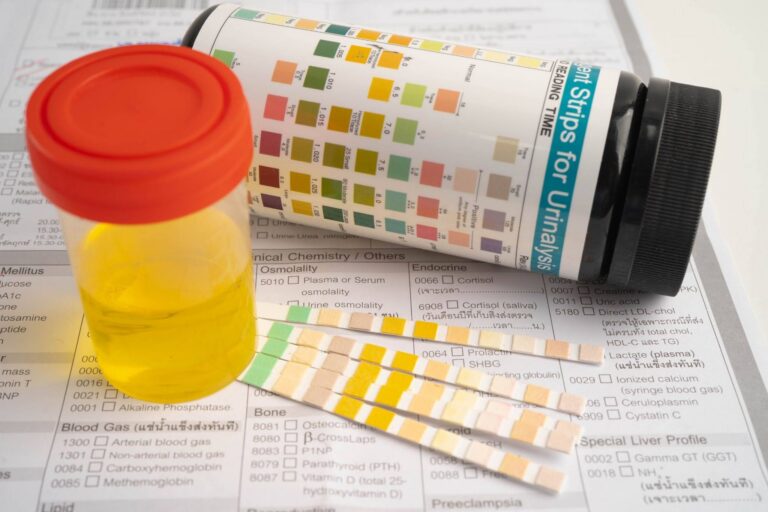 Does Concentra Test for Synthetic Urine?
