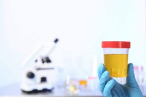 a gloved hand holding a container of urine with a microscope in the background