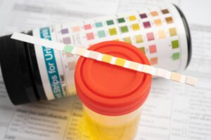 A urine cup with a reagent strip pH paper test and a comparison chart in a laboratory.
